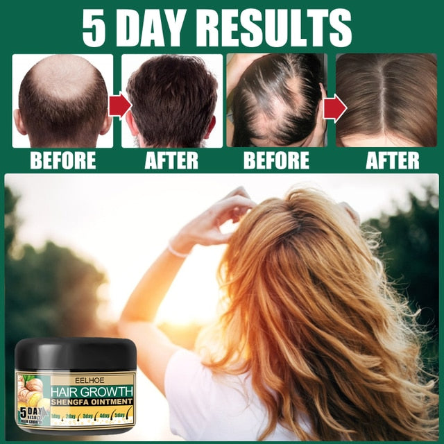 Hair Growth Cream & Product | Hair Loss Treatment