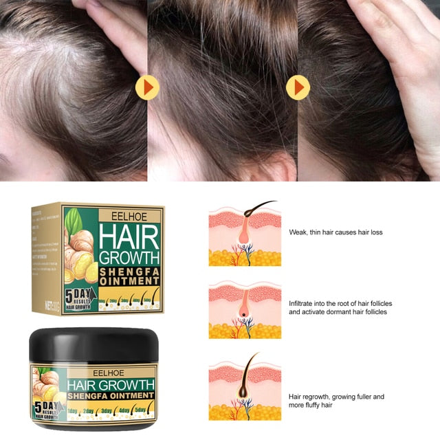 Hair Growth Cream & Product | Hair Loss Treatment